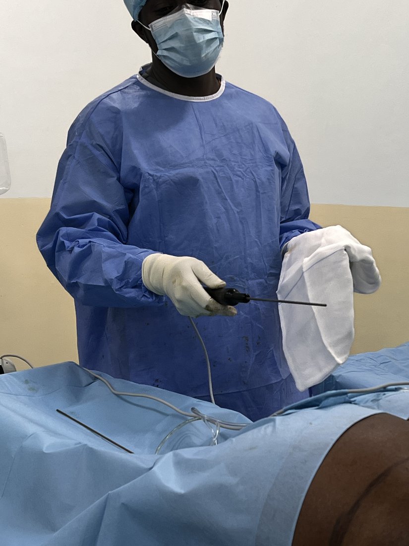 Liposuction photo 35